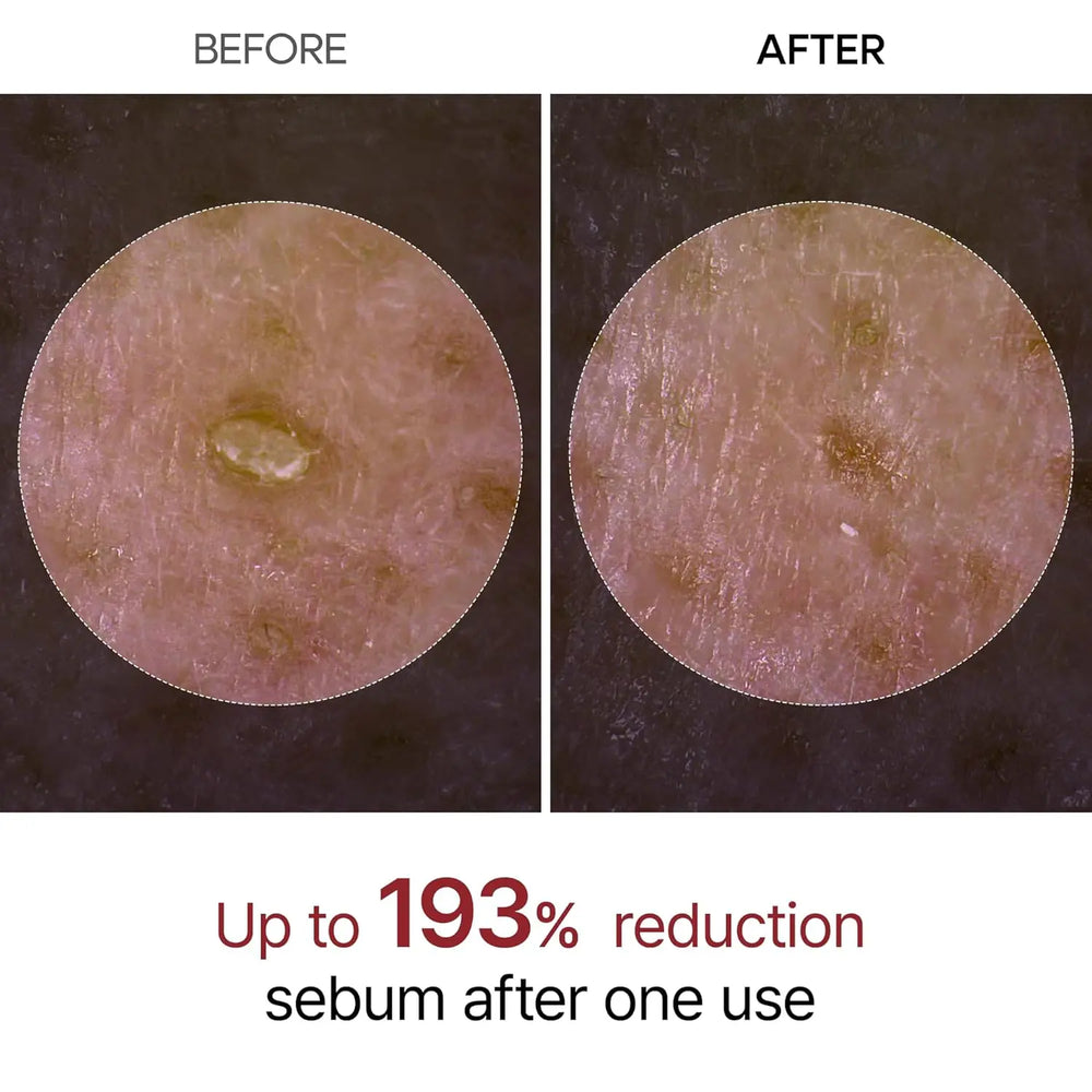 Dr Melaxin Peel Shot- A Radiant Glow Rice Peeling Ampoule Dermashift